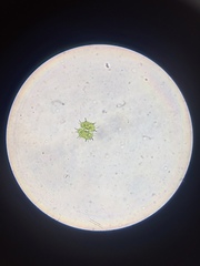 Xanthidium antilopaeum