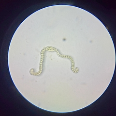Racomitrium fasciculare