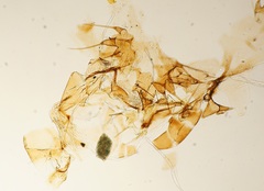 Arthropoda