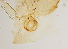 Arthropoda