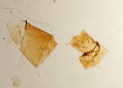 Arthropoda