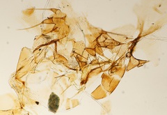 Arthropoda