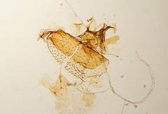 Arthropoda