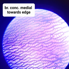 Sphagnum subsecundum