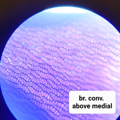 Sphagnum subsecundum