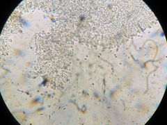 Mycena rubromarginata