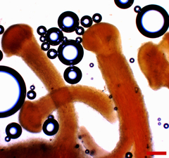 Stilbocrea macrostoma