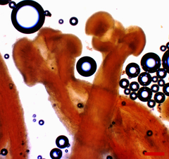 Stilbocrea macrostoma