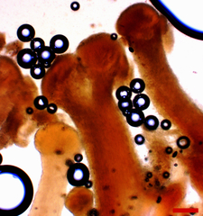 Stilbocrea macrostoma