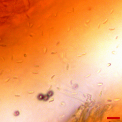 Stilbocrea macrostoma