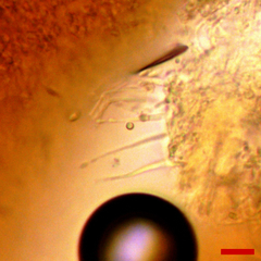 Stilbocrea macrostoma