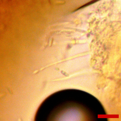 Stilbocrea macrostoma