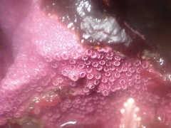 Stylantheca papillosa