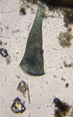 Stentor coeruleus