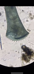 Stentor coeruleus