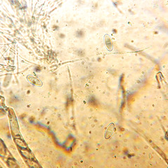 Lasiobolus macrotrichus