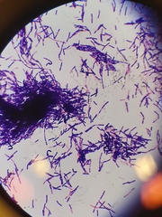 Bacillus cereus