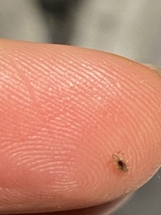 Pediculus humanus capitis