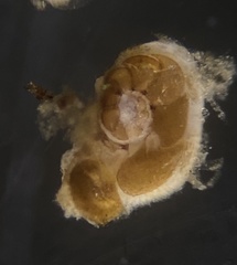 Cibicididae