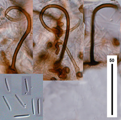 Circinotrichum maculiforme