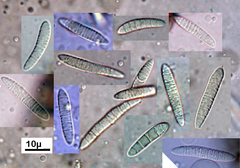 Aotearoamyces nothofagi image