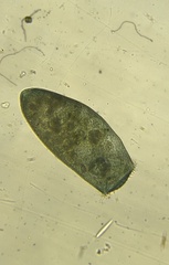Stentor coeruleus