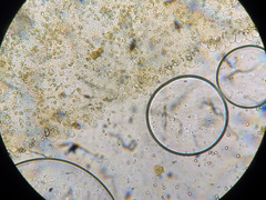Cystoagaricus hirtosquamulosus