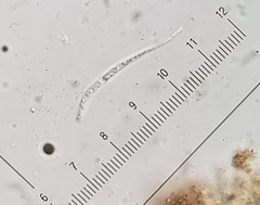 Scoliciosporum chlorococcum