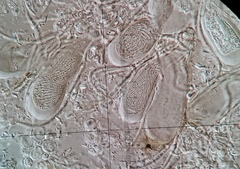Scoliciosporum chlorococcum