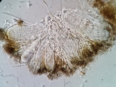 Scoliciosporum chlorococcum