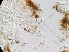 Scoliciosporum chlorococcum