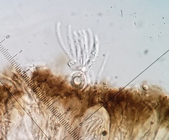 Scoliciosporum chlorococcum