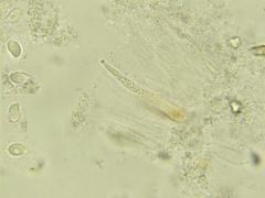 Clavariadelphus subfastigiatus