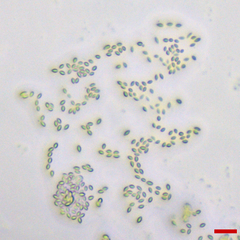 Lachnellula resinaria