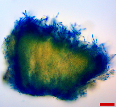 Lachnellula resinaria