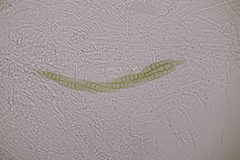 Leptosphaeria acuta