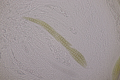 Leptosphaeria acuta