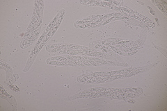 Cryptodiaporthe aesculi