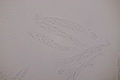 Cryptodiaporthe aesculi