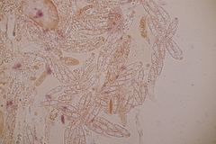 Cryptodiaporthe aesculi