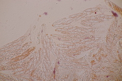 Cryptodiaporthe aesculi