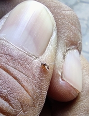 Simuliidae