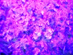 Lepraria hodkinsoniana