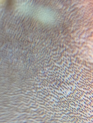 Phellinus betulinus