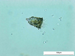 Codonella
