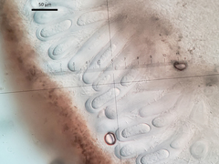 Lepra trachythallina