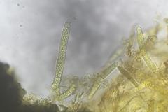 Leptosphaeria