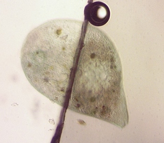 Stentor coeruleus