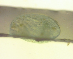 Stentor coeruleus