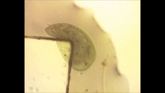 Stentor coeruleus